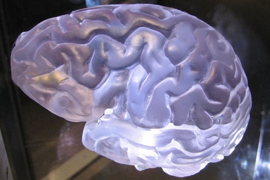 Vegas Lab Says Intense Workouts Turn Blood Into Hormone Express To The Brain