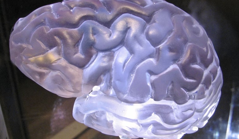 Vegas Lab Says Intense Workouts Turn Blood Into Hormone Express To The Brain