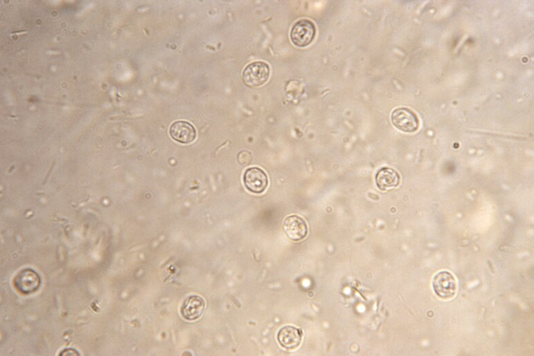 Cryptosporidium Detected in Portland's Drinking Water Supply, Public Health Measures Underway