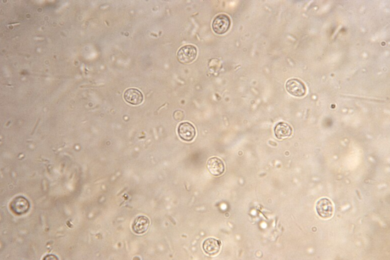Cryptosporidium Detected in Portland's Drinking Water Supply, Public Health Measures Underway