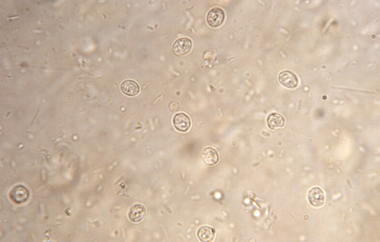 Cryptosporidium Detected in Portland's Drinking Water Supply, Public Health Measures Underway