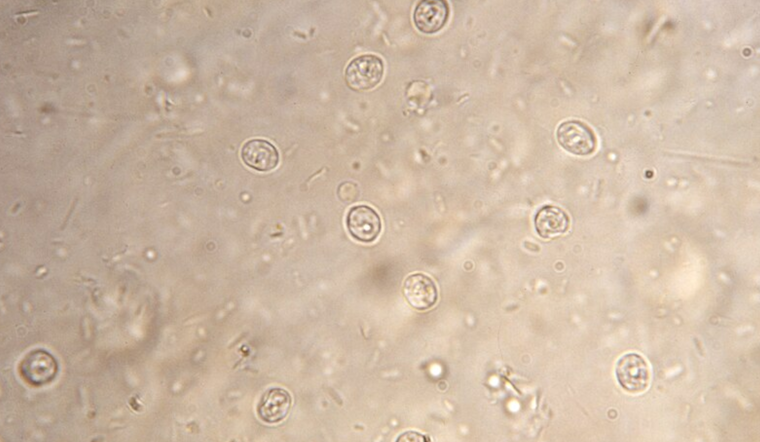 Cryptosporidium Detected in Portland's Drinking Water Supply, Public Health Measures Underway