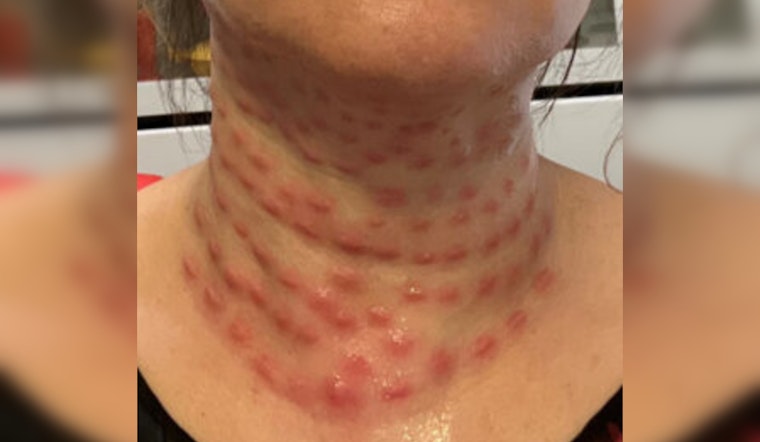 Flushing Cosmetologist Charged with Assault for Illegal Beauty Treatments, Could Face 7 Years in Prison