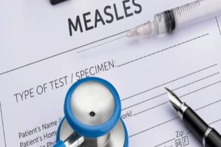Measles Case Confirmed in Rockwall County, Health Officials Urge Vigilance and Vaccination