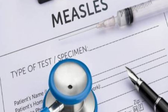 Measles Case Confirmed in Rockwall County, Health Officials Urge Vigilance and Vaccination