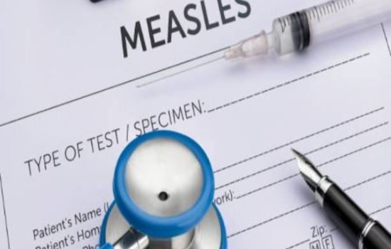 Measles Case Confirmed in Rockwall County, Health Officials Urge Vigilance and Vaccination