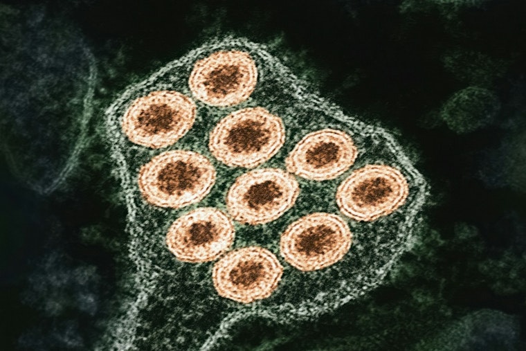 Pinal County Urges Pet Rabies Vaccinations Following Positive Test in Local Gray Fox