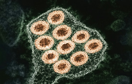 Pinal County Urges Pet Rabies Vaccinations Following Positive Test in Local Gray Fox
