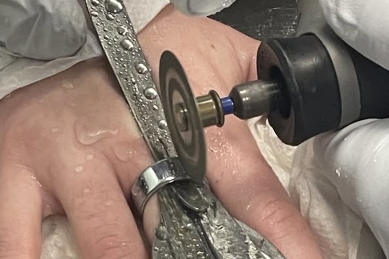 Portland Firefighters Employ Diamond-Tipped Blade to Remove Stuck High-Tech Ring