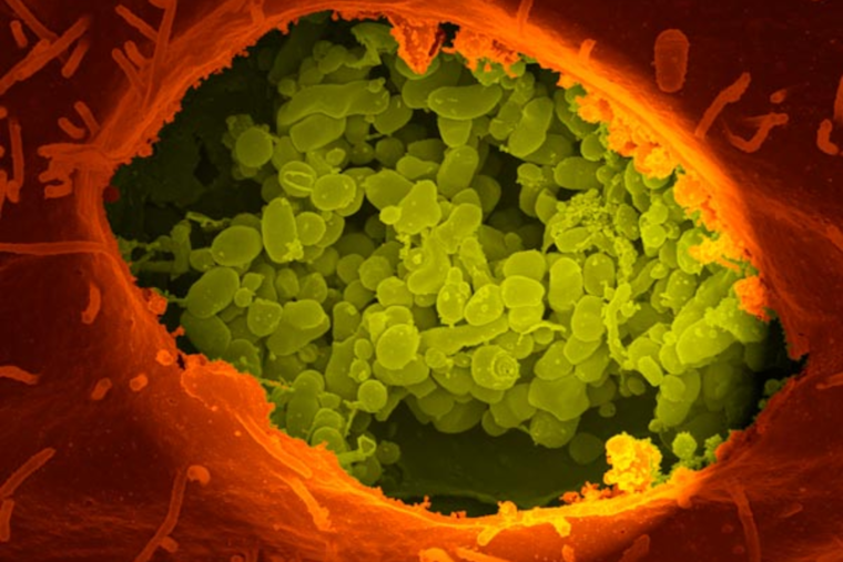 Texas Livestock Producers on Alert for Q Fever During Spring Birthing Season