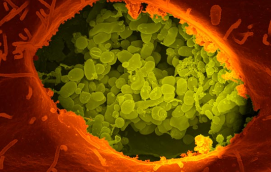Texas Livestock Producers on Alert for Q Fever During Spring Birthing Season