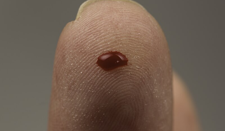 Game-Changing Blood Test Developed by UTEP Researchers Aims to Revolutionize Colorectal Cancer Detection