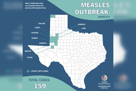 Houston and Harris County Tackle Measles Proactively with No Active Cases Amid West Texas Surge