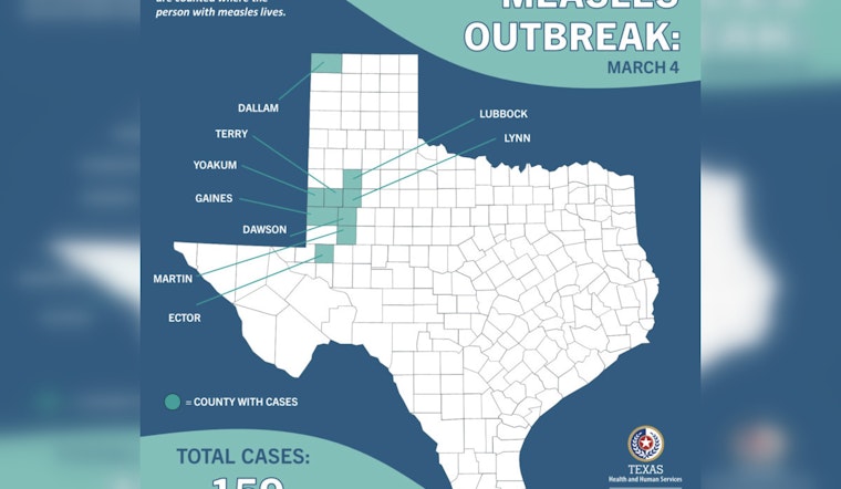 Houston and Harris County Tackle Measles Proactively with No Active Cases Amid West Texas Surge