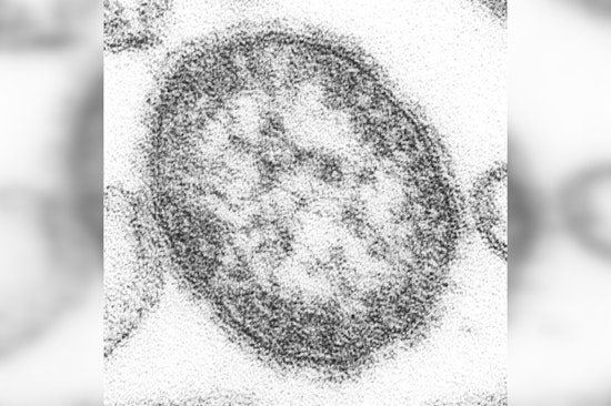 Houston Reports Third Measles Case of the Year in Unvaccinated Infant After International Travel