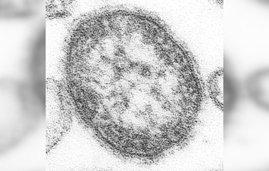 Houston Reports Third Measles Case of the Year in Unvaccinated Infant After International Travel
