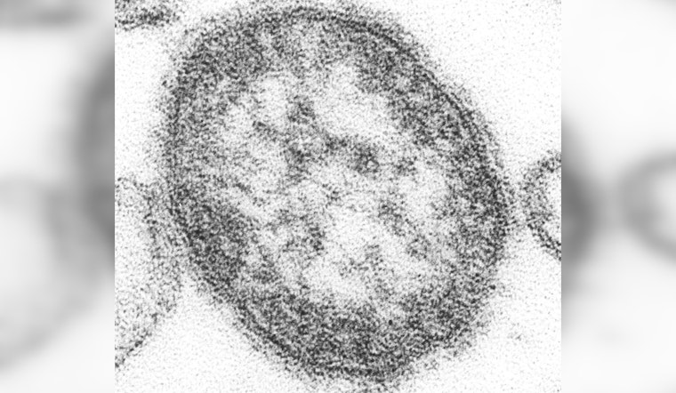 Houston Reports Third Measles Case of the Year in Unvaccinated Infant After International Travel