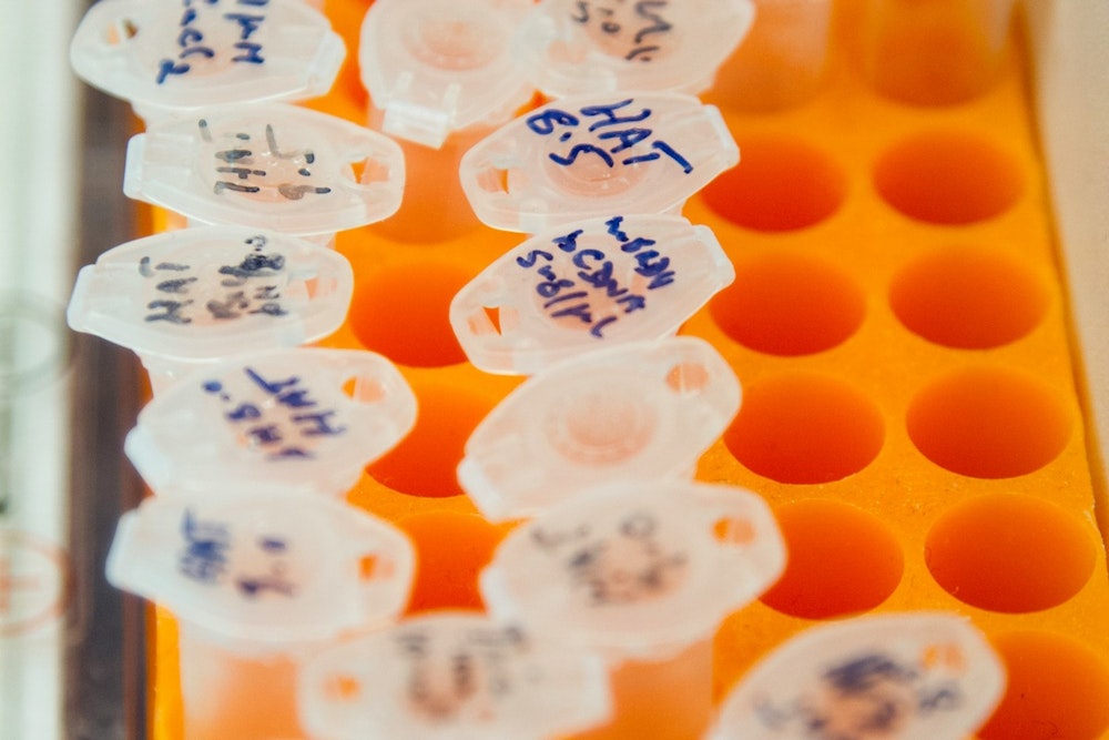 Los Angeles County Sheriff's Department Admits Using Flawed DNA Test Kits, Prompting 4,000 Sample Retests