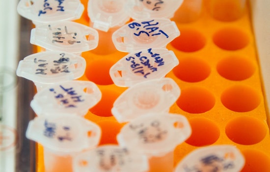 Los Angeles County Sheriff's Department Admits Using Flawed DNA Test Kits, Prompting 4,000 Sample Retests