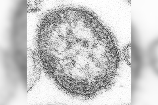 Measles Case Confirmed in Howard County, Maryland, Health Officials Issue Exposure Warning