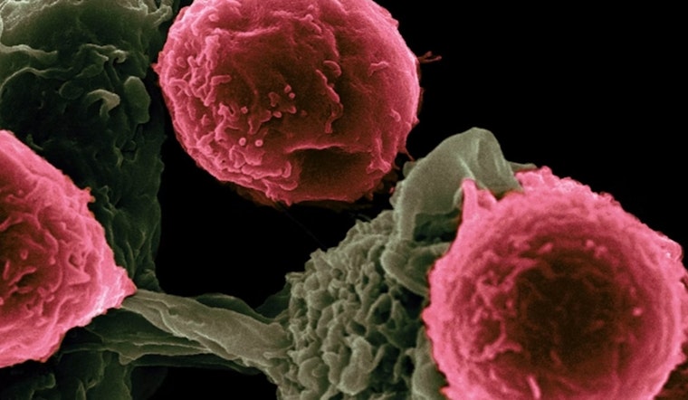 West Palm Beach to Host Leukemia & Lymphoma Society Health Event at Morton's Steakhouse