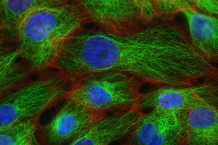 MIT Engineers Develop Precision-Controlled Gene Therapy Circuit, Advancing Treatments for Genetic Disorders