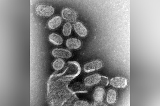 North Carolina Faces Worst Flu Season Since 2009 with Over 500 Deaths Amid Public Health Funding Cuts