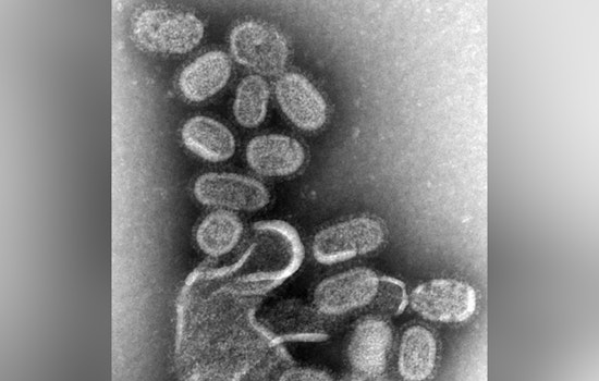 North Carolina Faces Worst Flu Season Since 2009 with Over 500 Deaths Amid Public Health Funding Cuts
