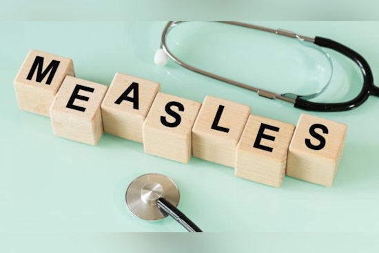 Oakland and Macomb Counties in Michigan Report Cases of Mumps and Measles, Prompting Vaccination Urges