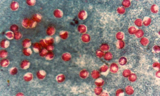 Portland Water Bureau Detects Cryptosporidium in Bull Run Watershed, No Immediate Health Threat Confirmed