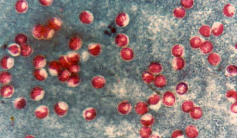 Portland Water Bureau Detects Cryptosporidium in Bull Run Watershed, No Immediate Health Threat Confirmed