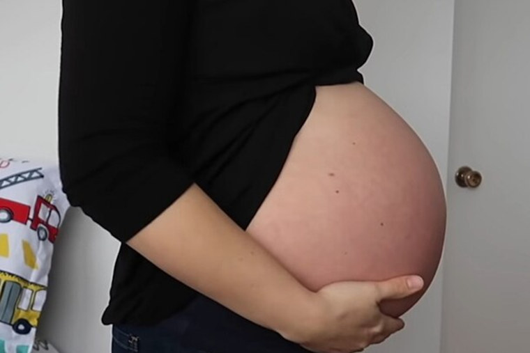 Post-Pregnancy Hypertension Tied to Increased Risk of Heart Disease and Chronic Illness, Experts Warn