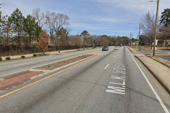 21-Year-Old Shot in Leg During Daytime Robbery in Atlanta, Police Seek Information