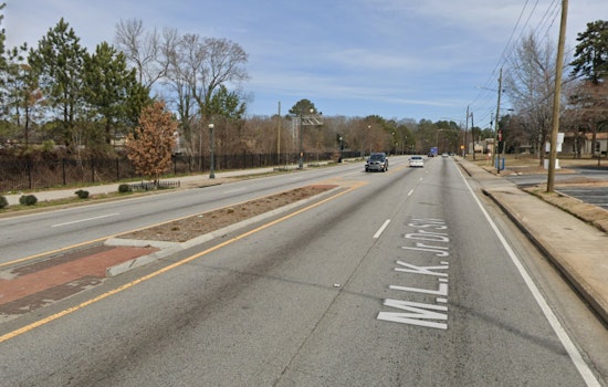21-Year-Old Shot in Leg During Daytime Robbery in Atlanta, Police Seek Information