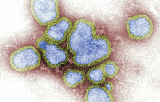 First Pediatric Flu Fatality in Riverside Signals Alarming Season High