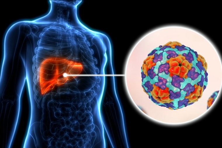 Los Angeles County Faces Surge in Hepatitis A Cases, Health Officials Urge Vaccination and Hygiene Practices