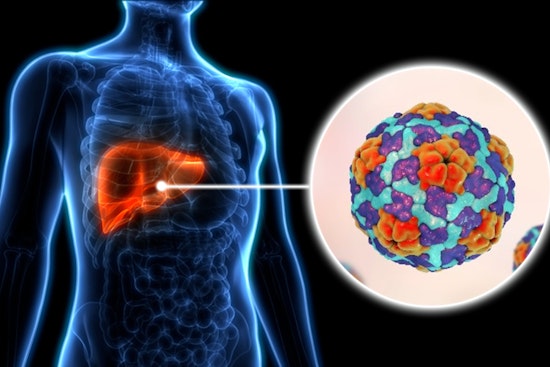 Los Angeles County Faces Surge in Hepatitis A Cases, Health Officials Urge Vaccination and Hygiene Practices