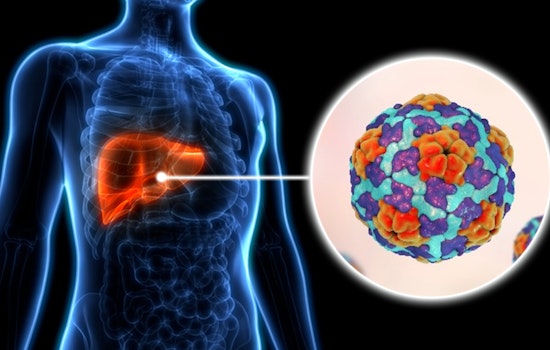 Los Angeles County Faces Surge in Hepatitis A Cases, Health Officials Urge Vaccination and Hygiene Practices