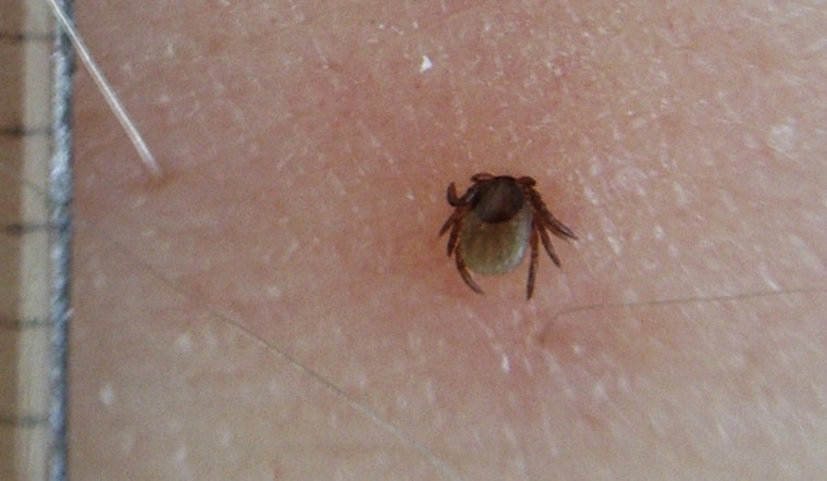 Lyme Disease Cases Surge by 168% in Michigan, Health Officials Urge Caution Amid Rising Tick-Borne Illnesses