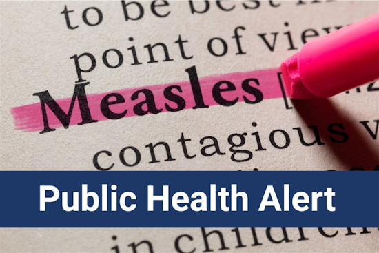 Measles Outbreak Strikes Tarrant County, Texas, Amid Public Exposure Alerts and Calls for Vaccination