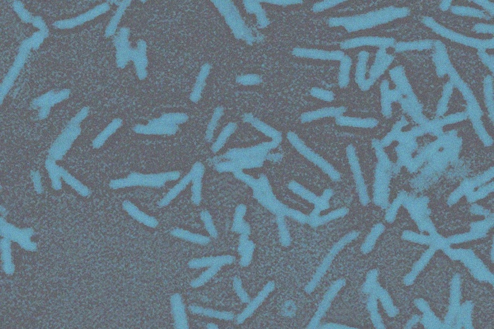 Medical Marvel as Oklahoma Scientists Turn Gut Bacteria Into Cancer Killing Machines
