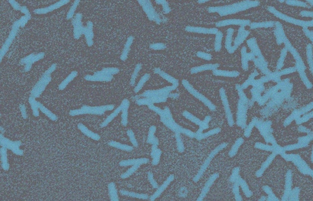 Medical Marvel as Oklahoma Scientists Turn Gut Bacteria Into Cancer Killing Machines