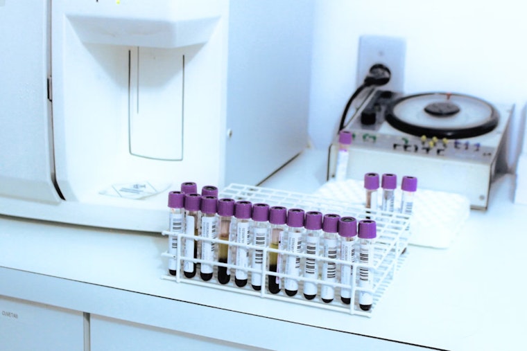 Michigan Mandates Blood Lead Testing for All Children Aged 1-2 to Combat Poisoning Risks