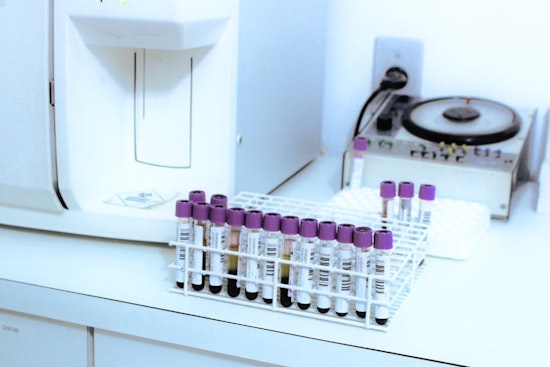 Michigan Mandates Blood Lead Testing for All Children Aged 1-2 to Combat Poisoning Risks
