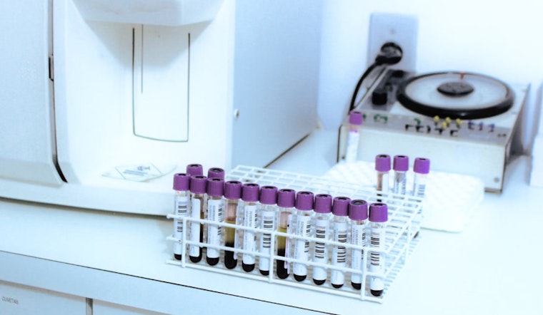 Michigan Mandates Blood Lead Testing for All Children Aged 1-2 to Combat Poisoning Risks