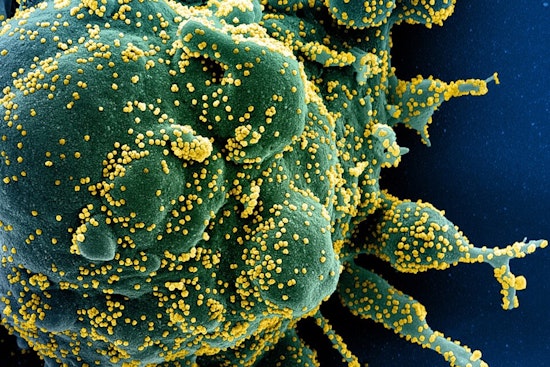 New COVID-19 Variant NB.1.8.1 Raises Alarm in California as FDA Adjusts Vaccine Policy Amidst Concerns