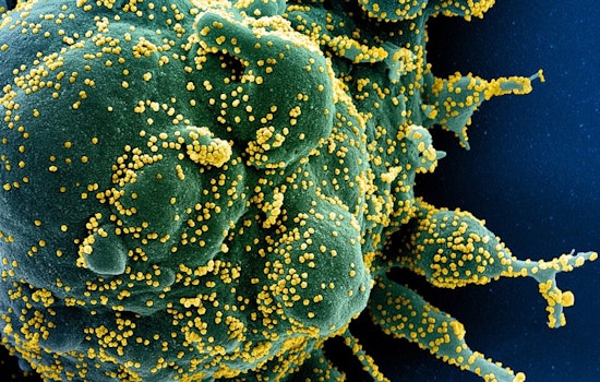 New COVID-19 Variant NB.1.8.1 Raises Alarm in California as FDA Adjusts Vaccine Policy Amidst Concerns
