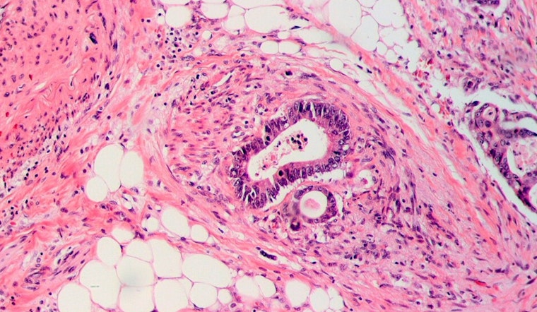 Ohio Scientists Forge Cancer-Fighting Sword with AI: Revolutionary PANDA Platform Promises Noninvasive Colorectal Screening Breakthrough