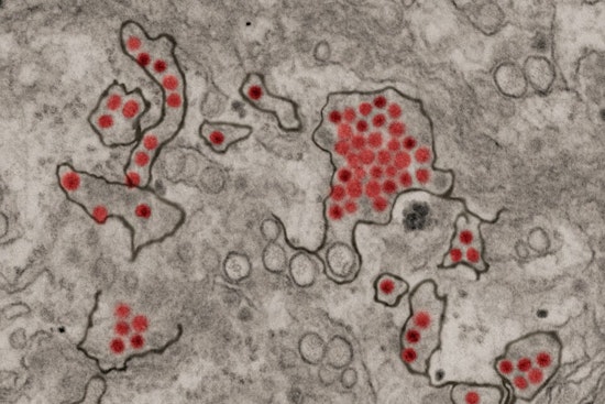 Ohio State University Study Reveals How Zika Virus Evades Human Immune Response to Spread Efficiently