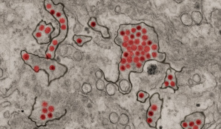 Ohio State University Study Reveals How Zika Virus Evades Human Immune Response to Spread Efficiently